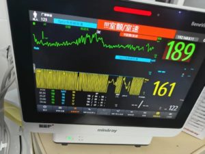 В нашей больнице успешно спасли жителя Пекина с остановкой сердца